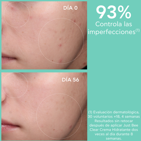 Just Bee Clear  Crema Anti-Imperfecciones Matificante Hidratante